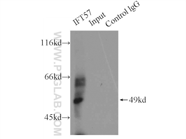IFT57 Antibody in Immunoprecipitation (IP)