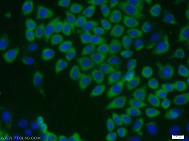 NME1 Antibody in Immunocytochemistry (ICC/IF)