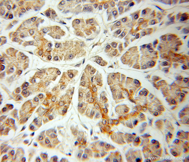 TID1 Antibody in Immunohistochemistry (Paraffin) (IHC (P))