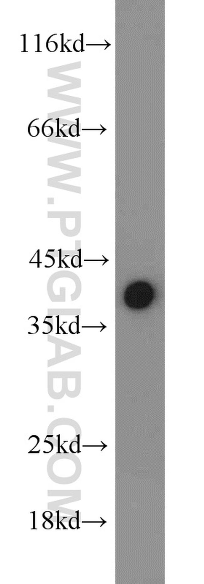 TID1 Antibody in Western Blot (WB)