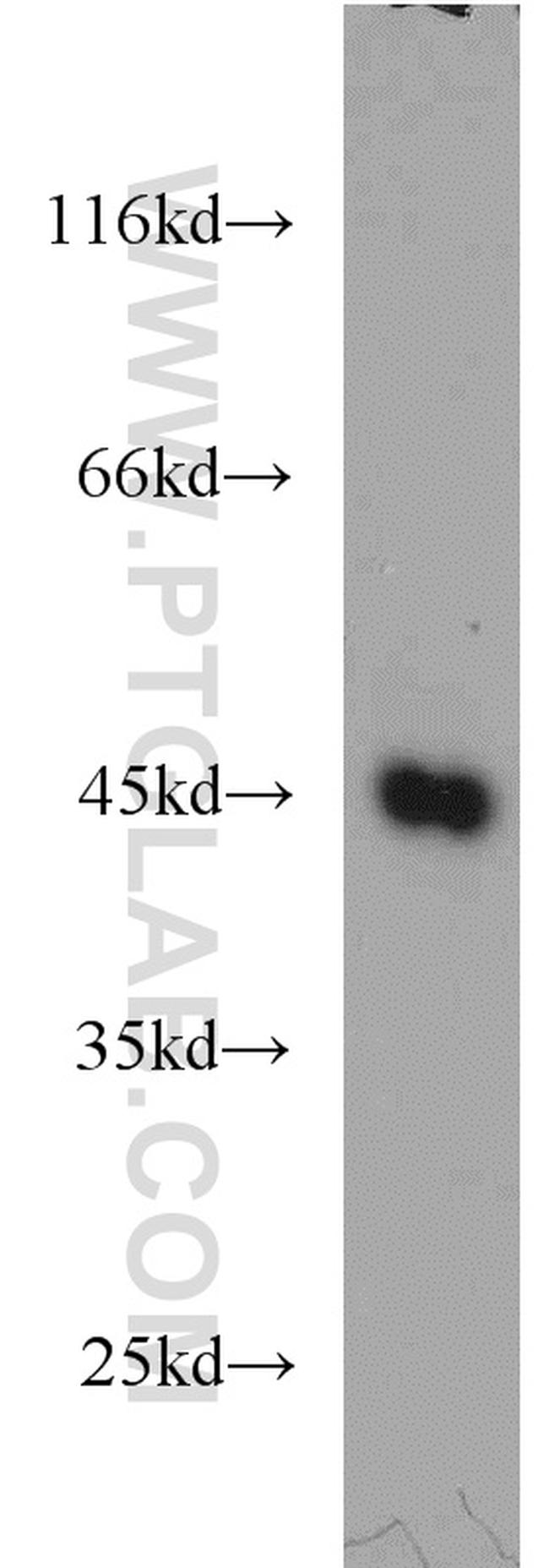 NFE2 Antibody in Western Blot (WB)