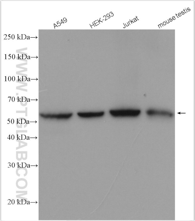 DNAJC7 Antibody in Western Blot (WB)