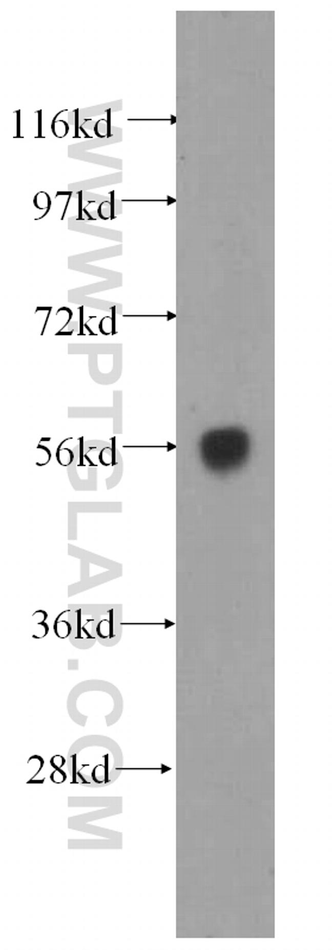 DNAJC7 Antibody in Western Blot (WB)