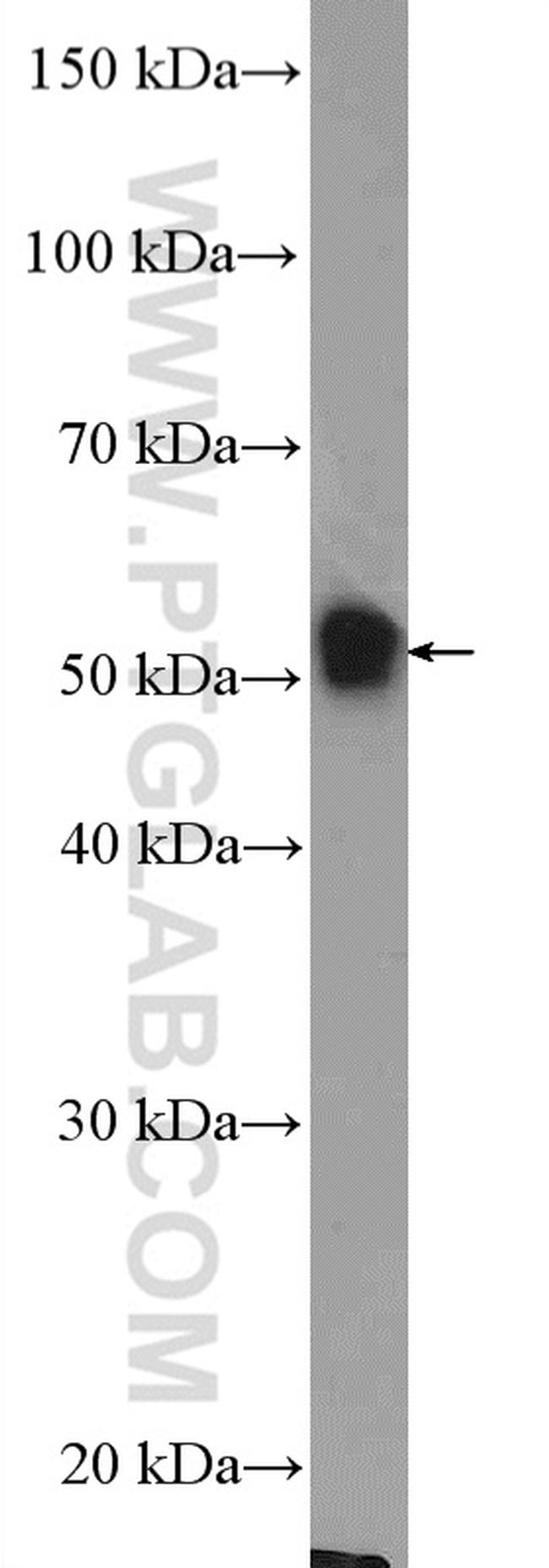 DNAJC7 Antibody in Western Blot (WB)