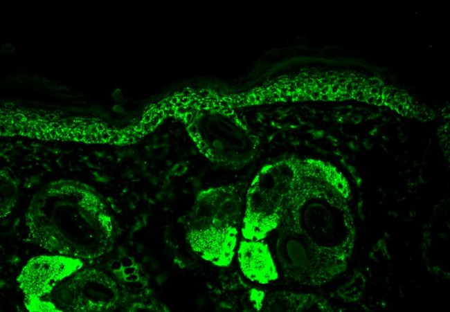 Hsp60 Antibody in Immunohistochemistry (Paraffin) (IHC (P))