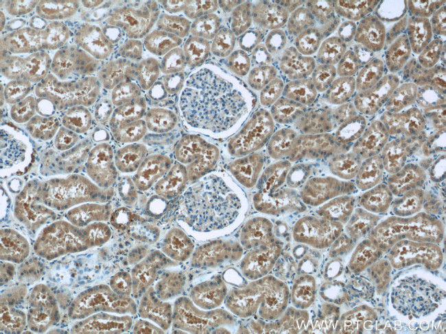 GNAI2 Antibody in Immunohistochemistry (Paraffin) (IHC (P))