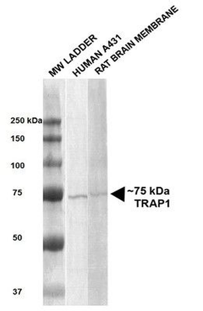 Trap1 Antibody in Western Blot (WB)