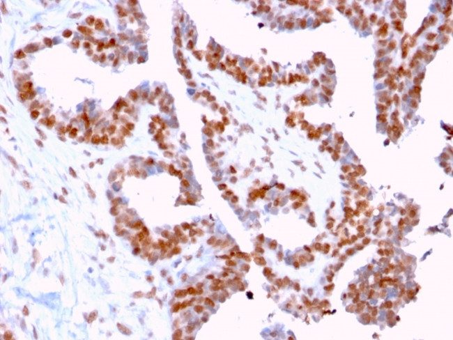 DMC1 Antibody in Immunohistochemistry (Paraffin) (IHC (P))