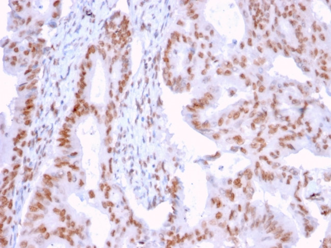 DMC1 Antibody in Immunohistochemistry (Paraffin) (IHC (P))