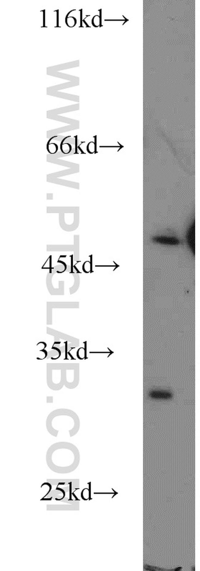 EIF2S3 Antibody in Western Blot (WB)