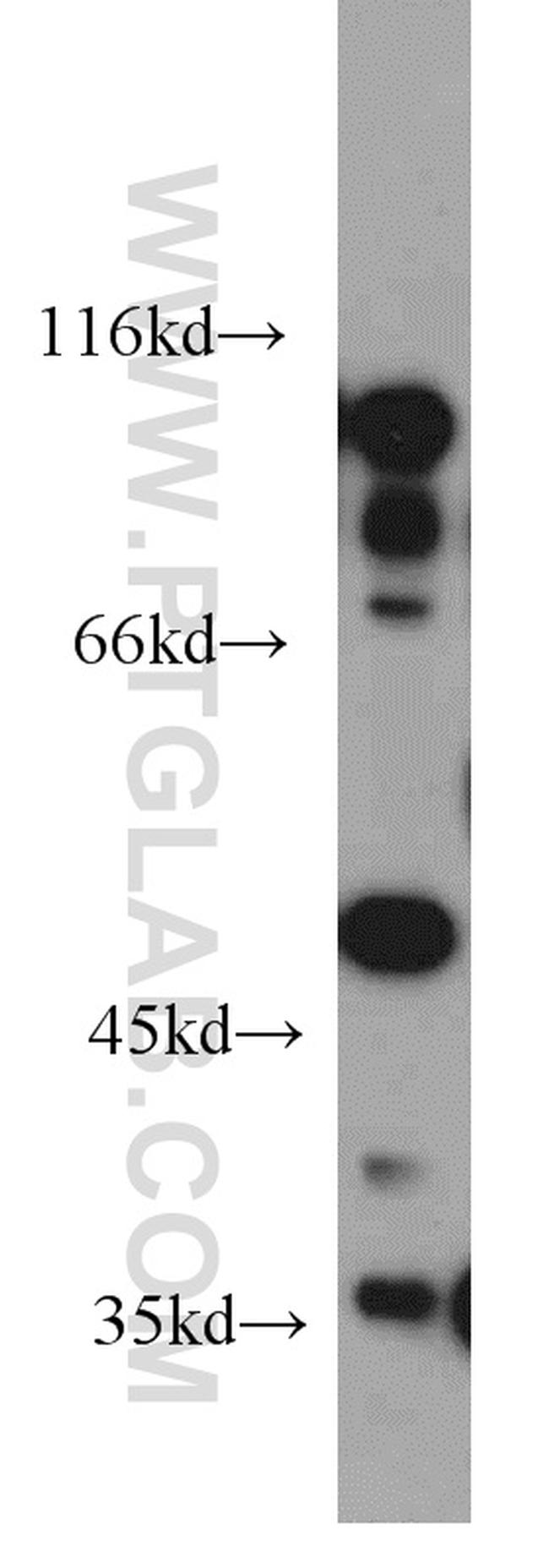 EIF2S3 Antibody in Western Blot (WB)