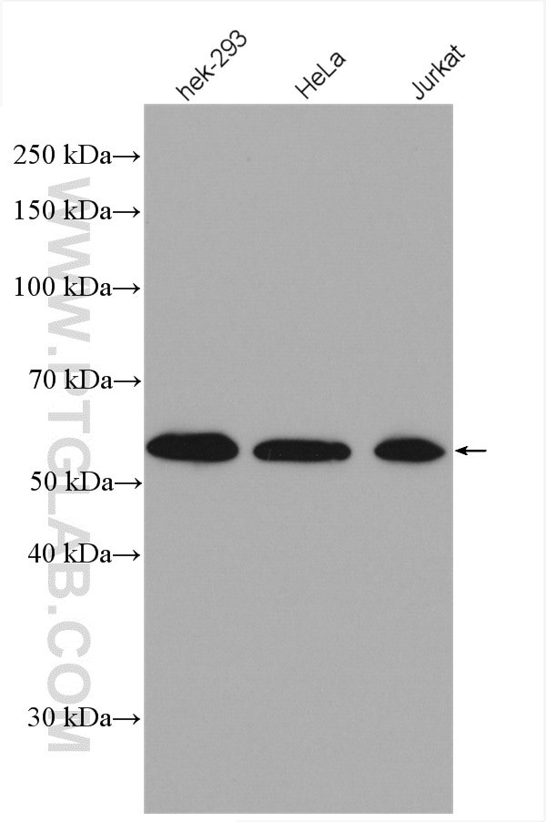 FKBP8 Antibody in Western Blot (WB)