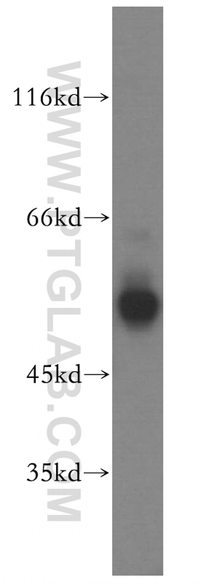 FKBP8 Antibody in Western Blot (WB)