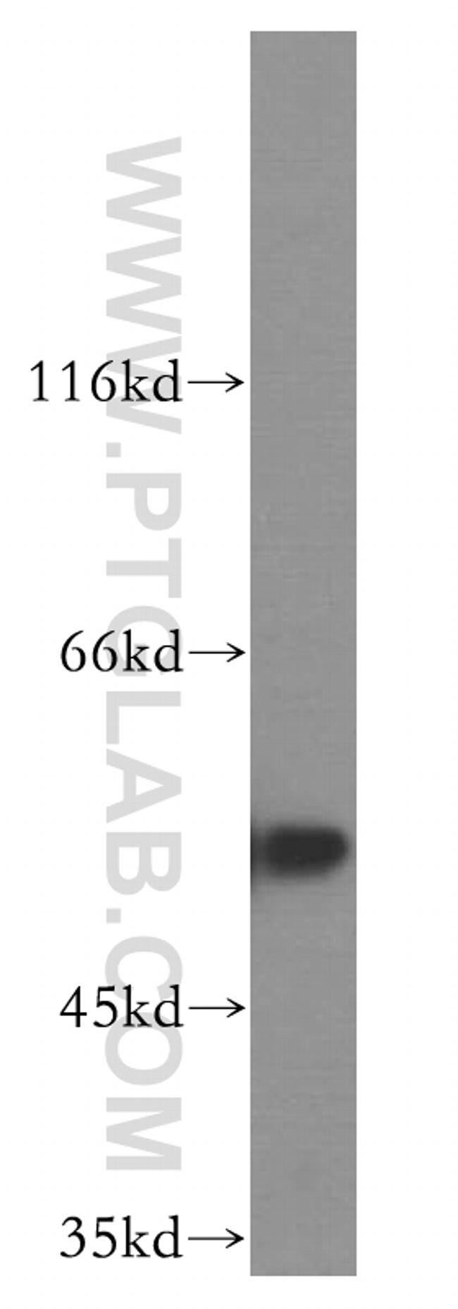 FKBP8 Antibody in Western Blot (WB)