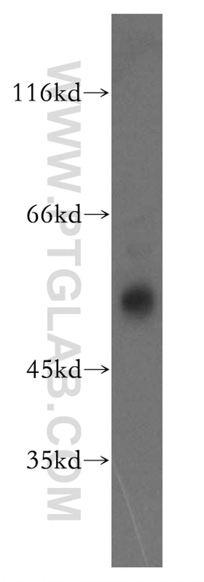 FKBP8 Antibody in Western Blot (WB)