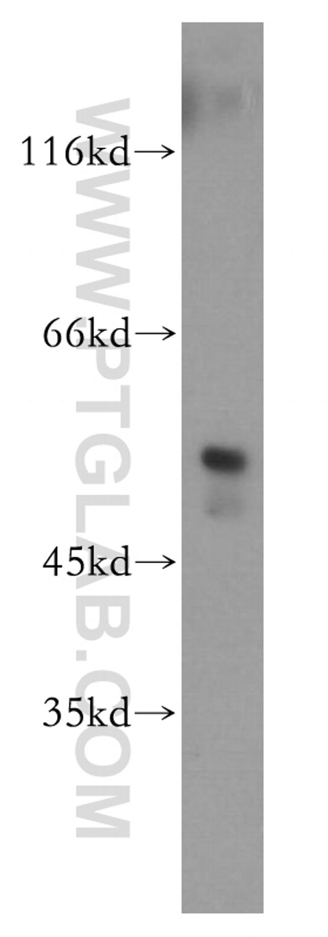 FKBP8 Antibody in Western Blot (WB)