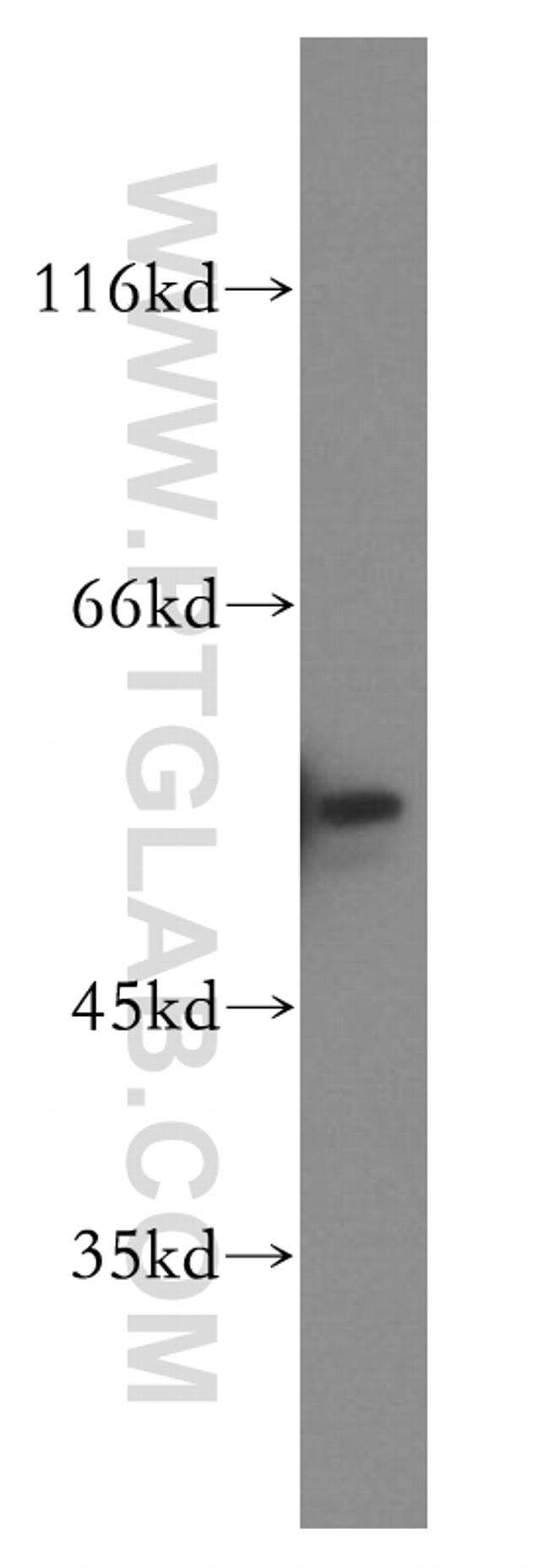 FKBP8 Antibody in Western Blot (WB)