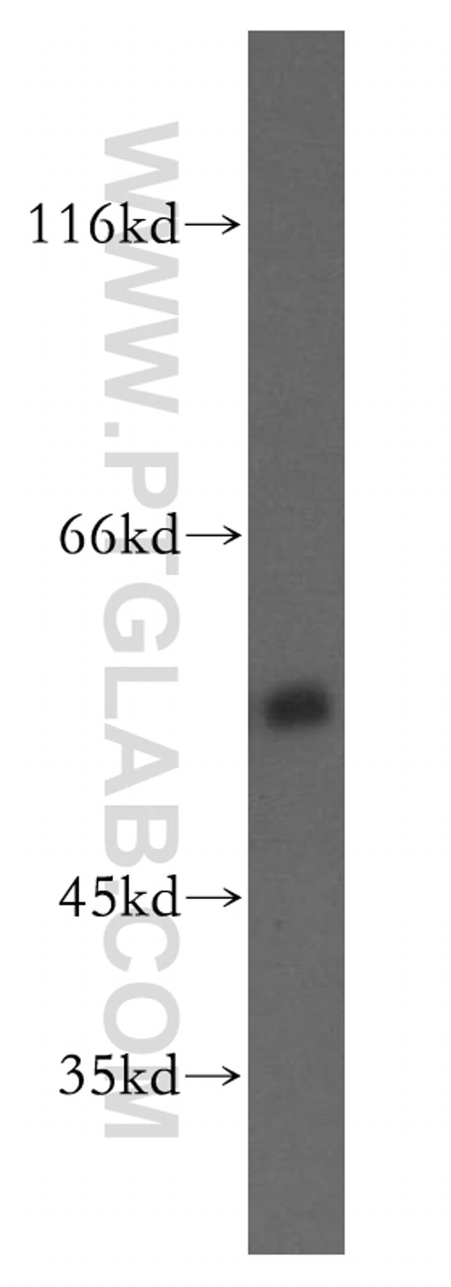 FKBP8 Antibody in Western Blot (WB)