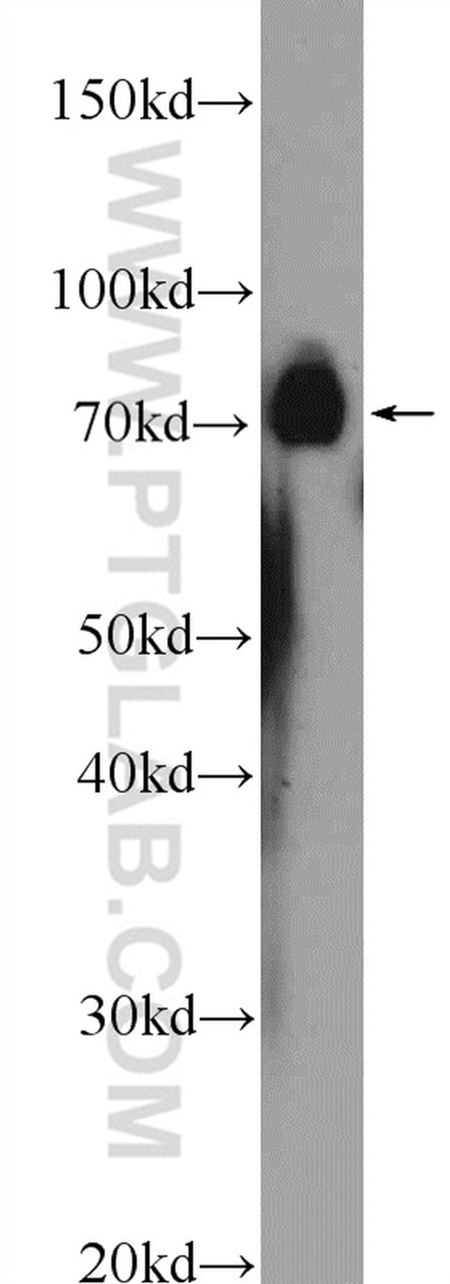 NUDT6 Antibody in Western Blot (WB)