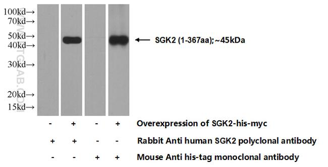 SGK2 Antibody in Western Blot (WB)