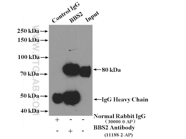 BBS2 Antibody in Immunoprecipitation (IP)
