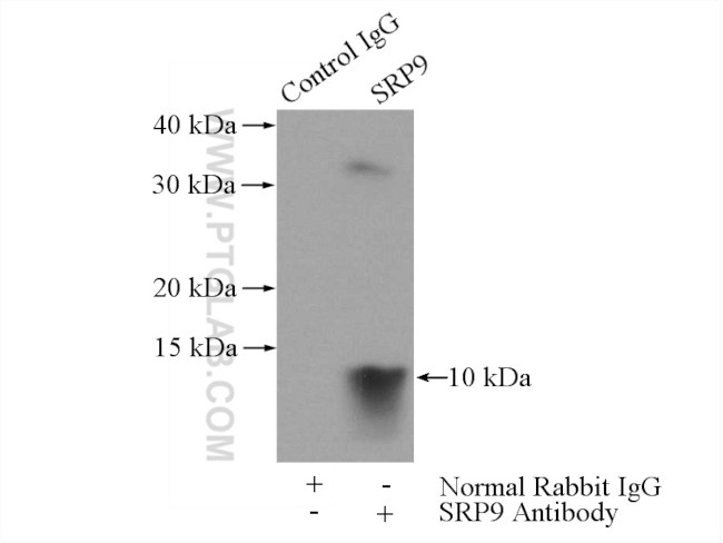 SRP9 Antibody in Immunoprecipitation (IP)