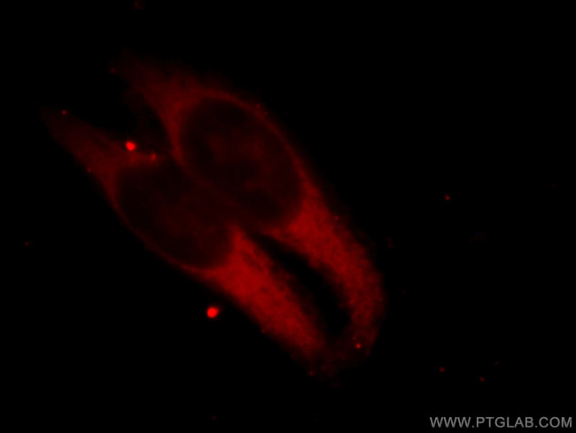 ILVBL Antibody in Immunocytochemistry (ICC/IF)