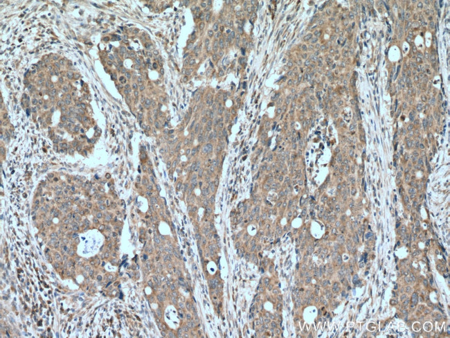 ILVBL Antibody in Immunohistochemistry (Paraffin) (IHC (P))