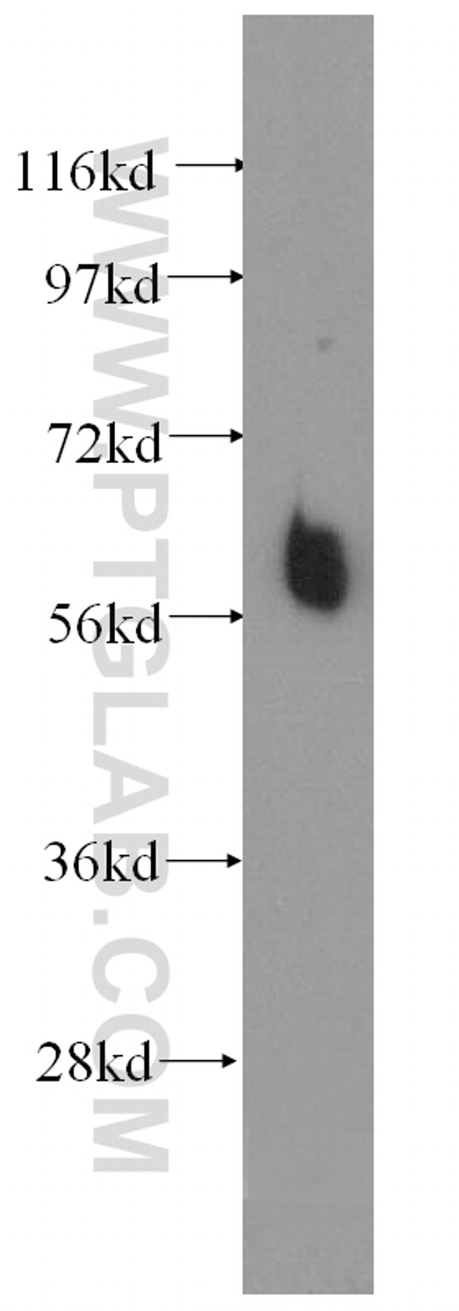 ILVBL Antibody in Western Blot (WB)