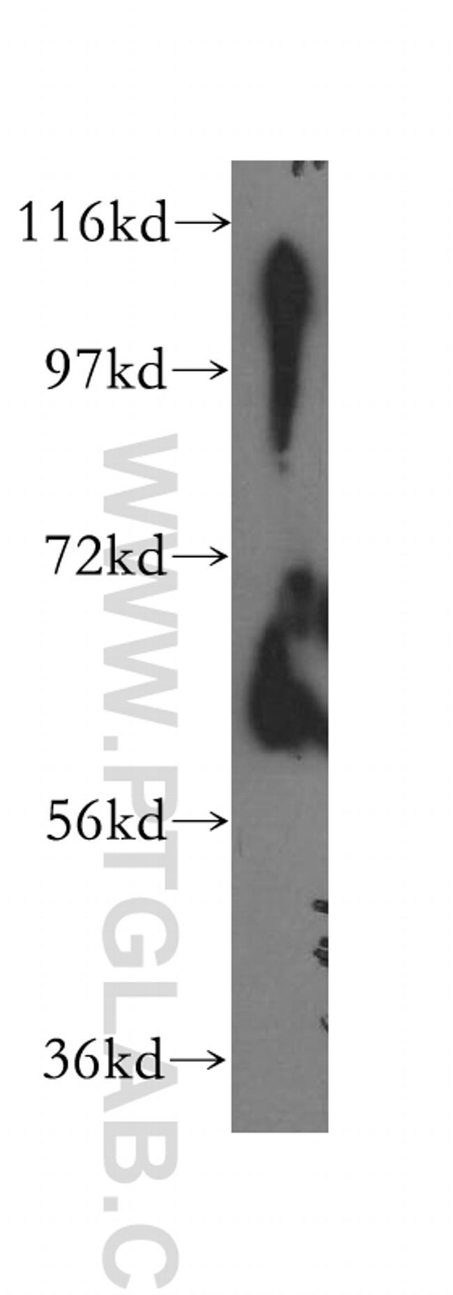 ILVBL Antibody in Western Blot (WB)