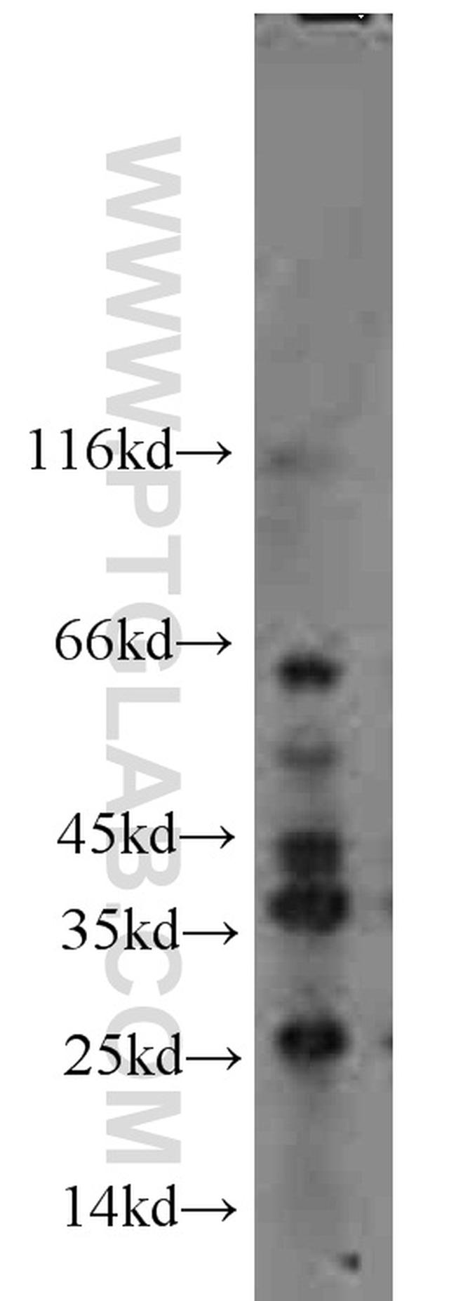 FLCN Antibody in Western Blot (WB)