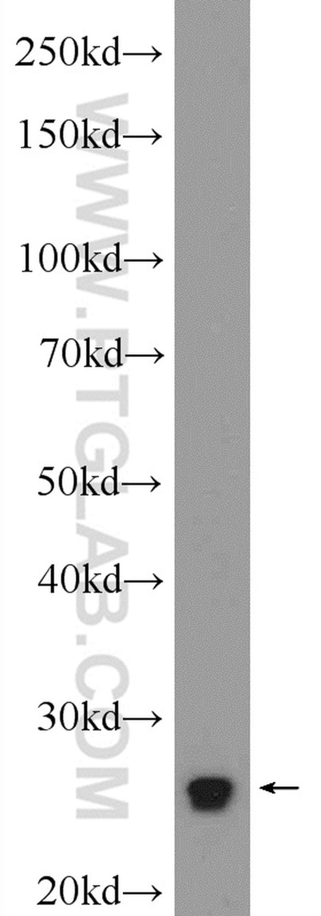 FLCN Antibody in Western Blot (WB)