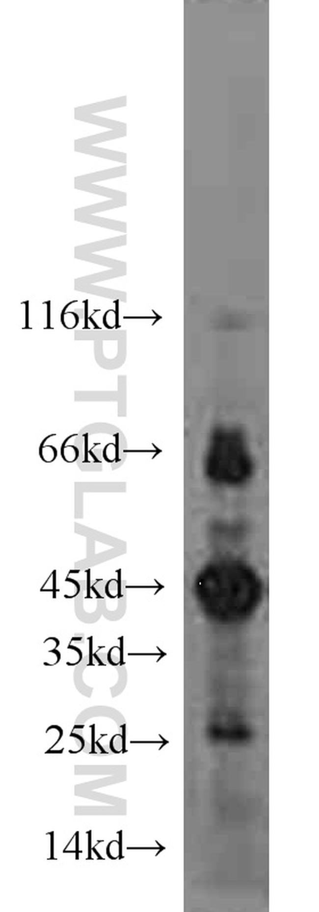 FLCN Antibody in Western Blot (WB)