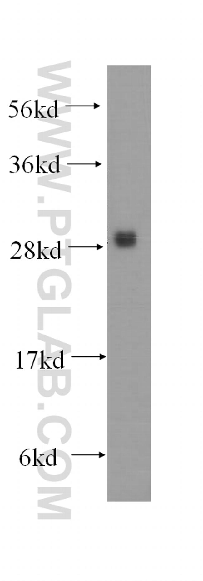 PMM1 Antibody in Western Blot (WB)