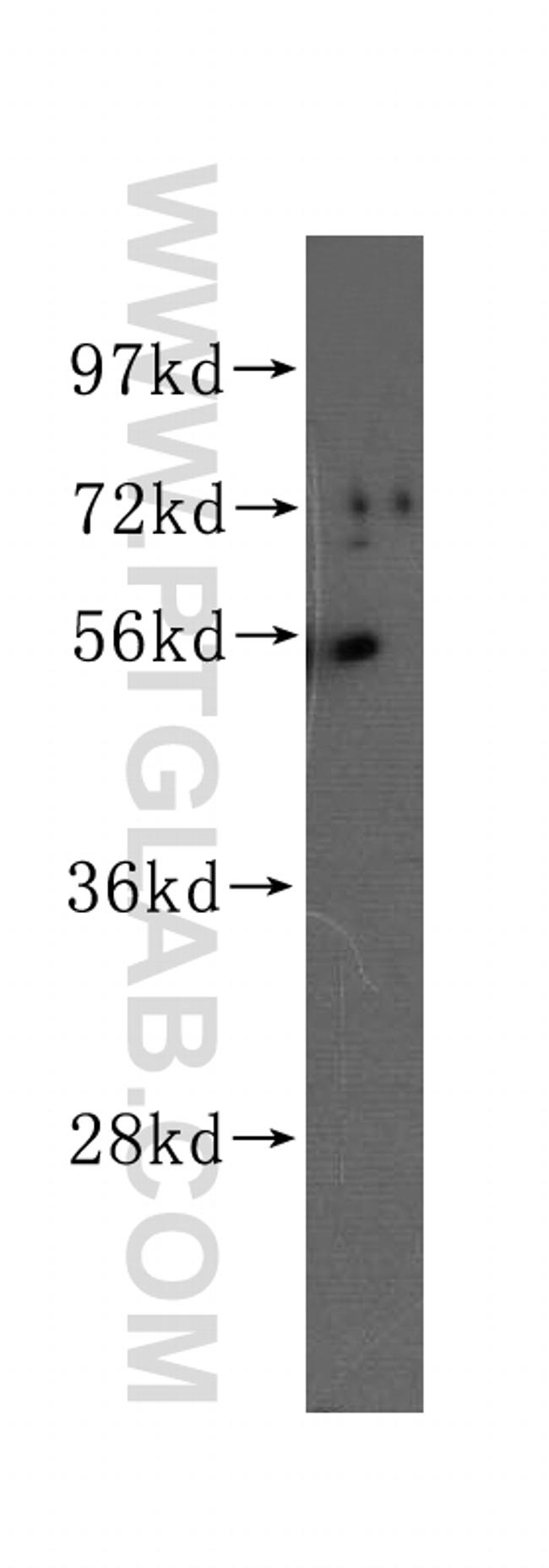 TMPRSS4 Antibody in Western Blot (WB)