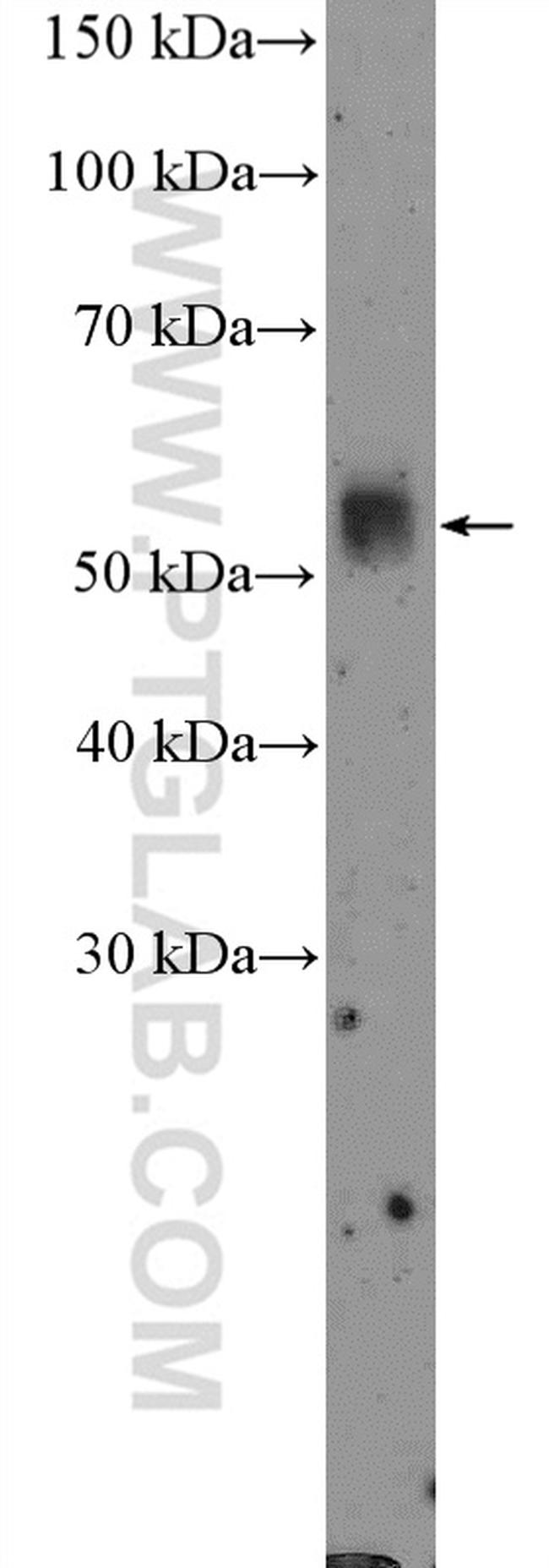 TMPRSS4 Antibody in Western Blot (WB)