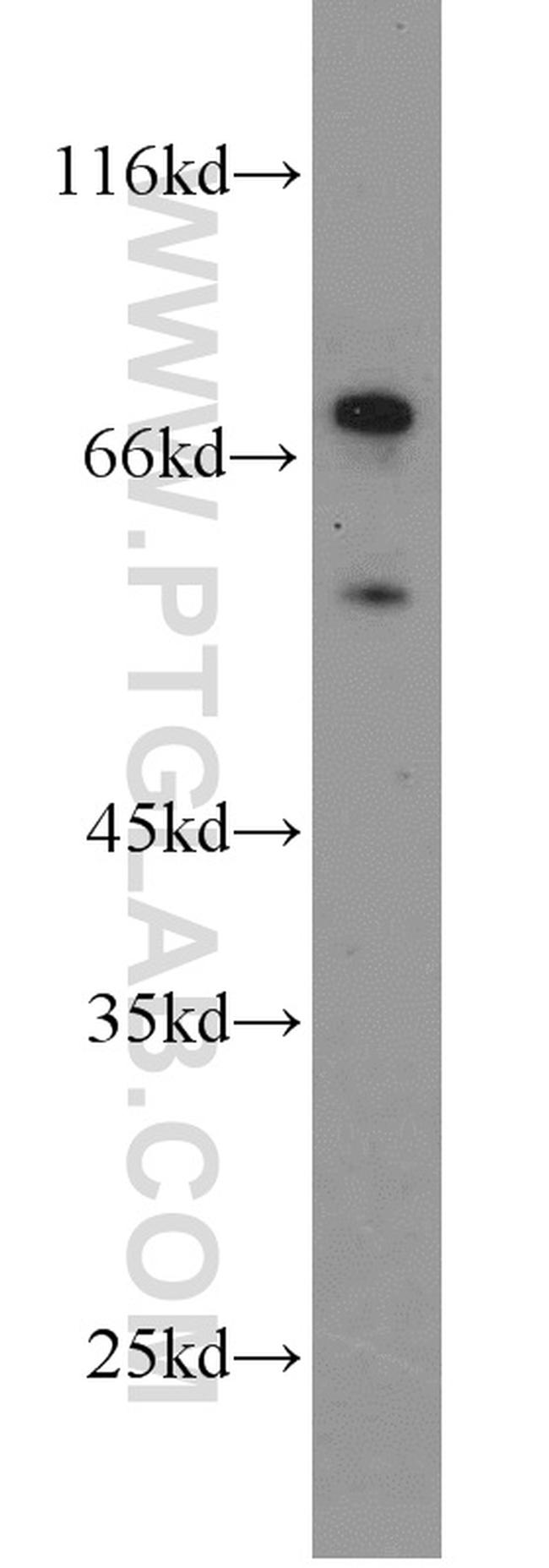 RNF156 Antibody in Western Blot (WB)