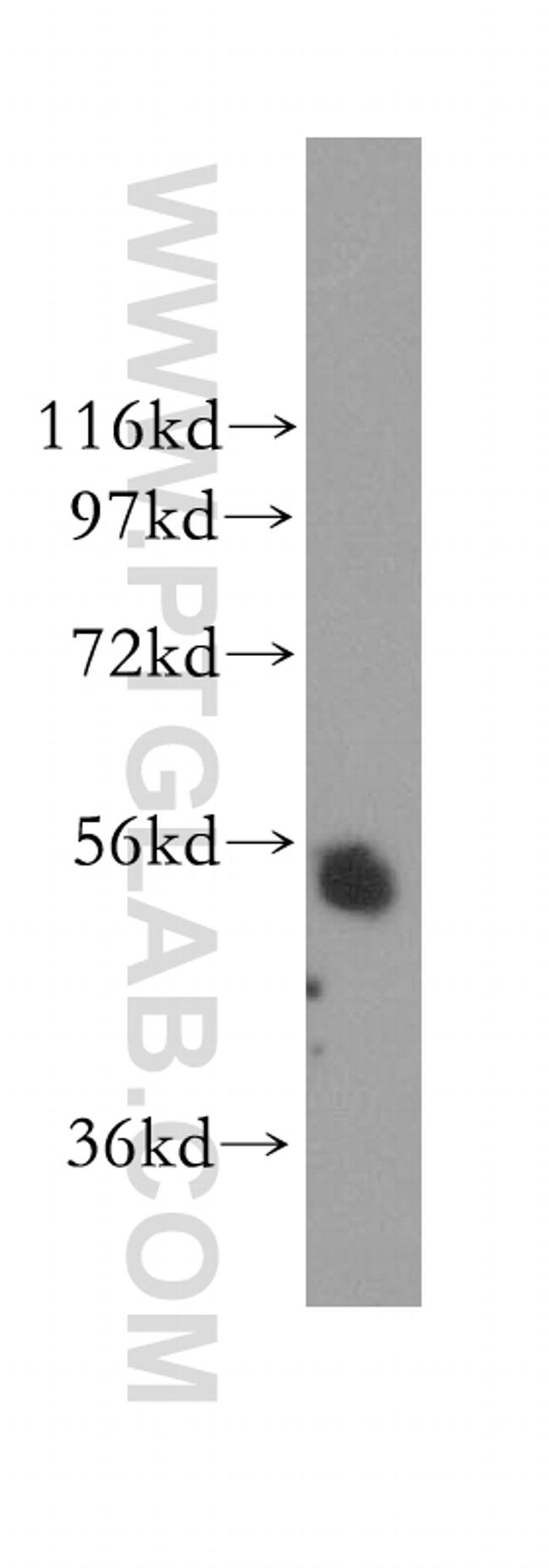 TADA2L Antibody in Western Blot (WB)