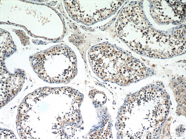 SERPINE2 Antibody in Immunohistochemistry (Paraffin) (IHC (P))