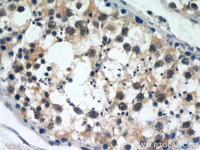 SERPINE2 Antibody in Immunohistochemistry (Paraffin) (IHC (P))