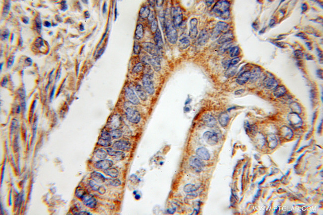 SERPINE2 Antibody in Immunohistochemistry (Paraffin) (IHC (P))