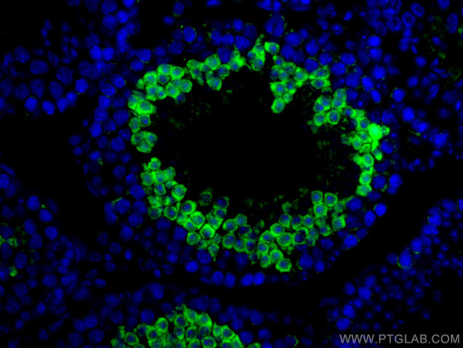 SERPINE2 Antibody in Immunohistochemistry (PFA fixed) (IHC (PFA))