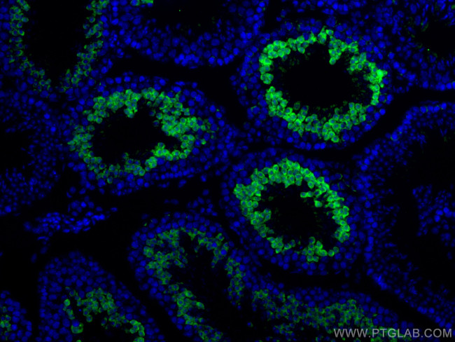 SERPINE2 Antibody in Immunohistochemistry (PFA fixed) (IHC (PFA))