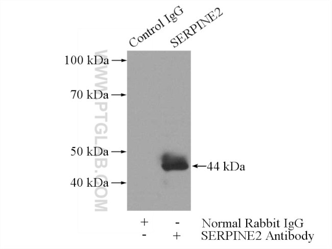 SERPINE2 Antibody in Immunoprecipitation (IP)