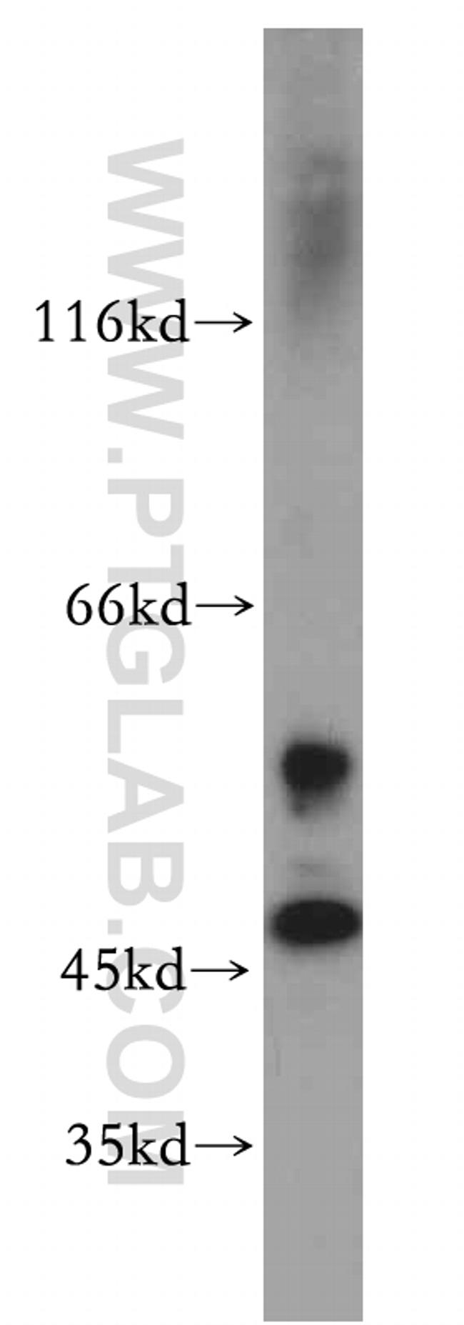 SERPINE2 Antibody in Western Blot (WB)