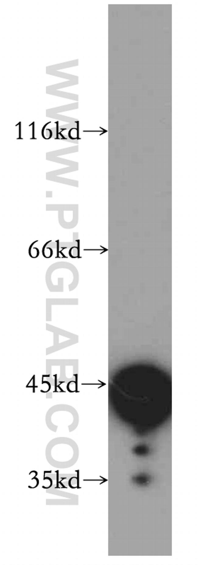 SERPINE2 Antibody in Western Blot (WB)