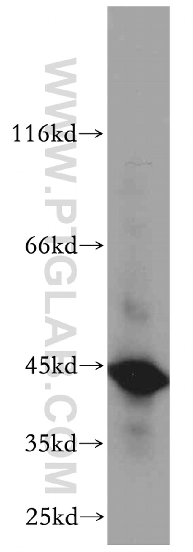 SERPINE2 Antibody in Western Blot (WB)