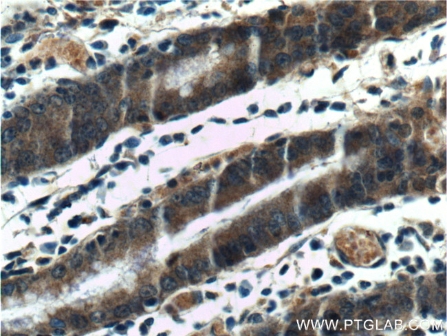 Beclin 1 Antibody in Immunohistochemistry (Paraffin) (IHC (P))