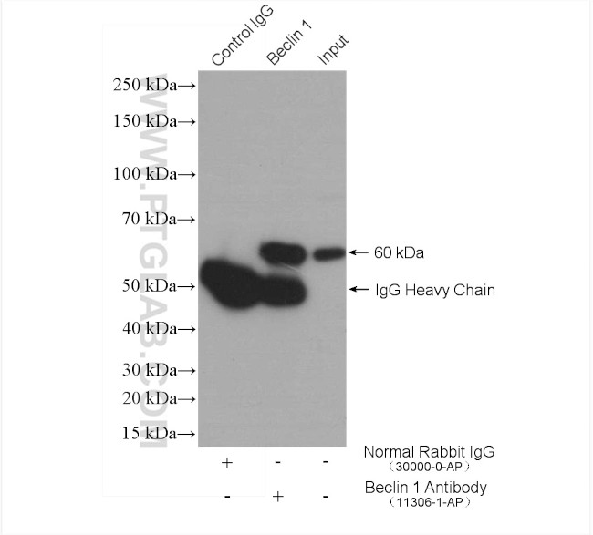 Beclin 1 Antibody in Immunoprecipitation (IP)