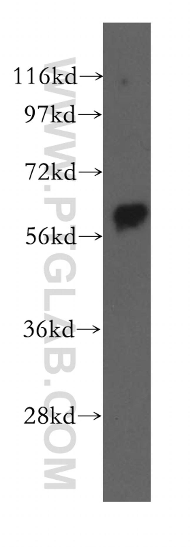 Beclin 1 Antibody in Western Blot (WB)